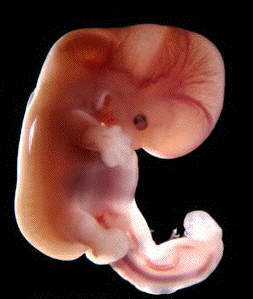 Foetus via baillement.com